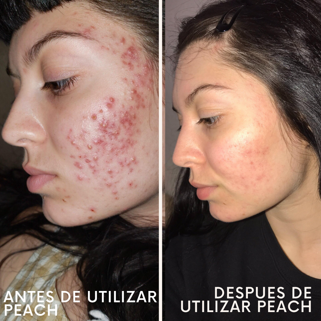 Peach Perfect Multivitamínico.