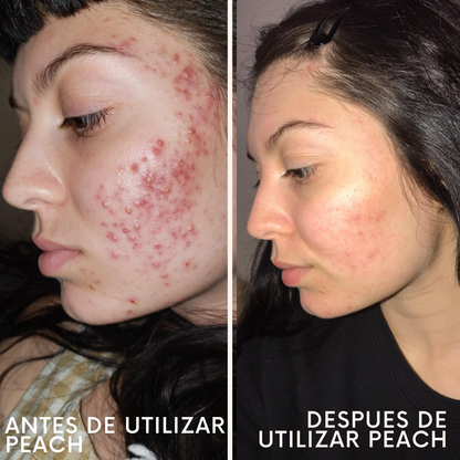 Peach Perfect Multivitamínico.